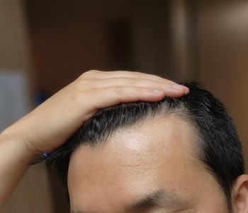 헤어라인