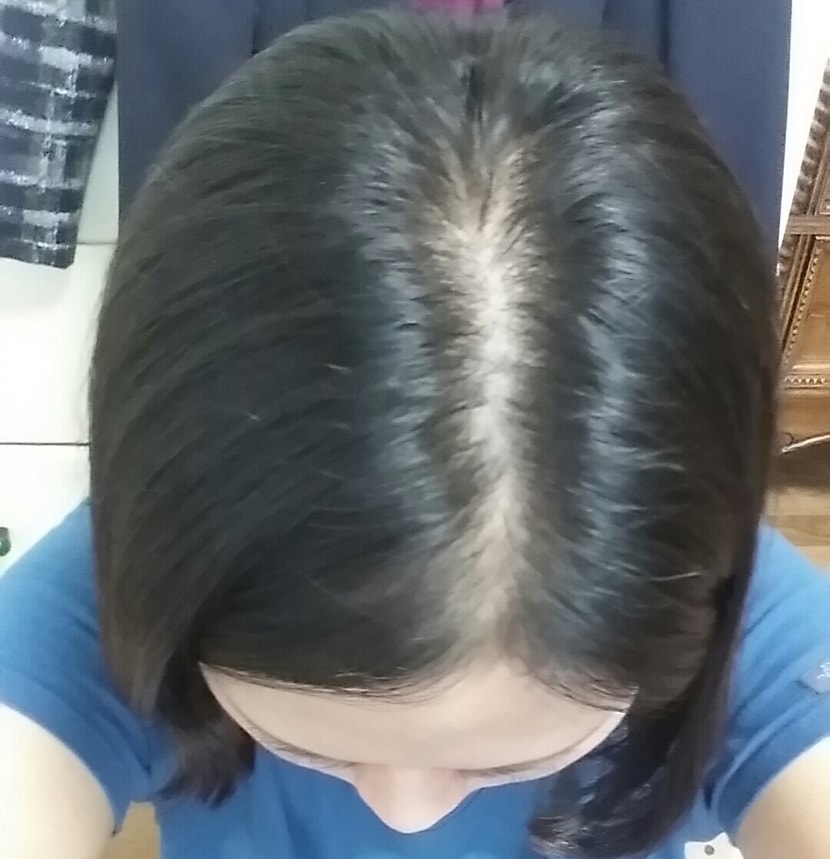 앞부분