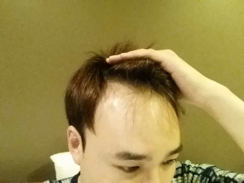 이마컷
