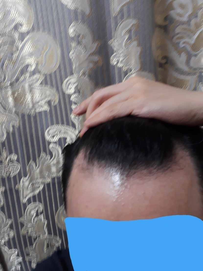 정면에서 본 엠자