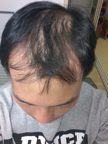 이현덕