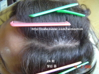 회복중 사진