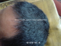 회복중 사진