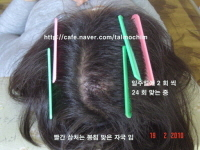 회복중 사진