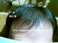회복중 사진