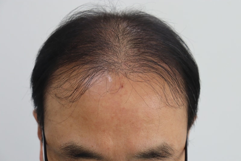 박성현수술전.jpg