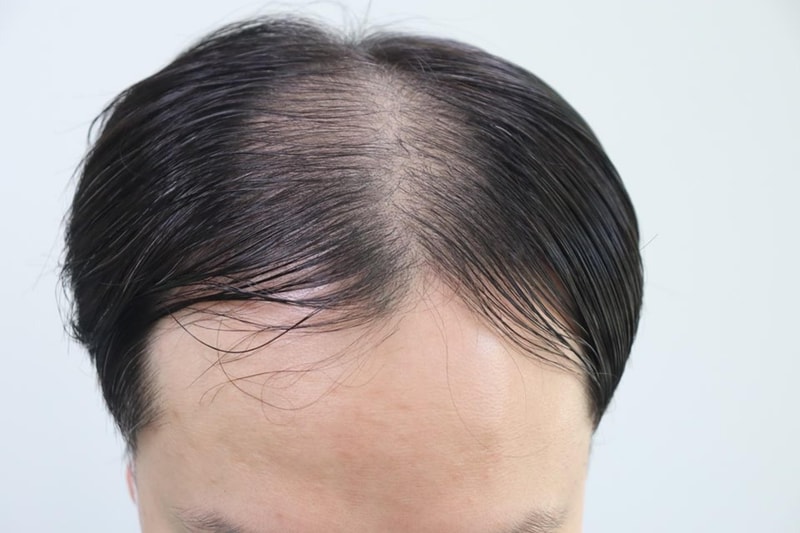 박세현수술전.jpg