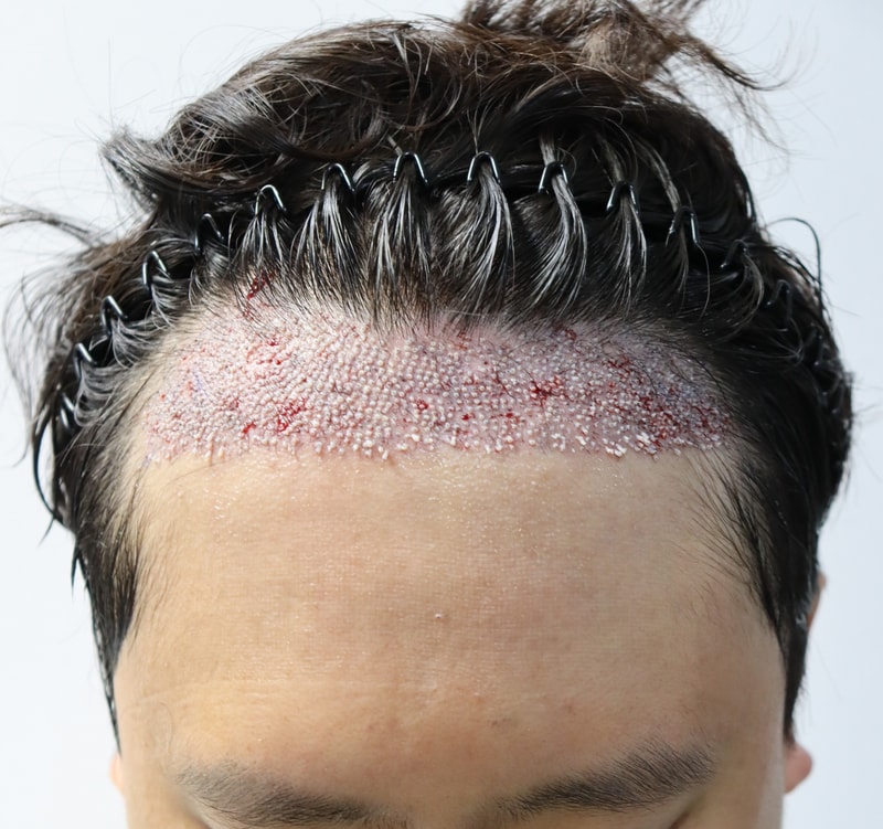 서울_이강석 후.JPG