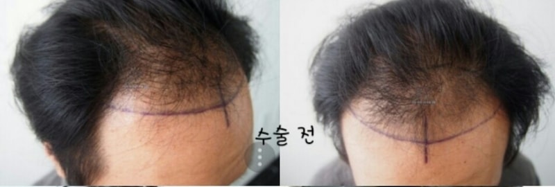 어느덧 4개월이 되었습니다. 후기 올립니다.