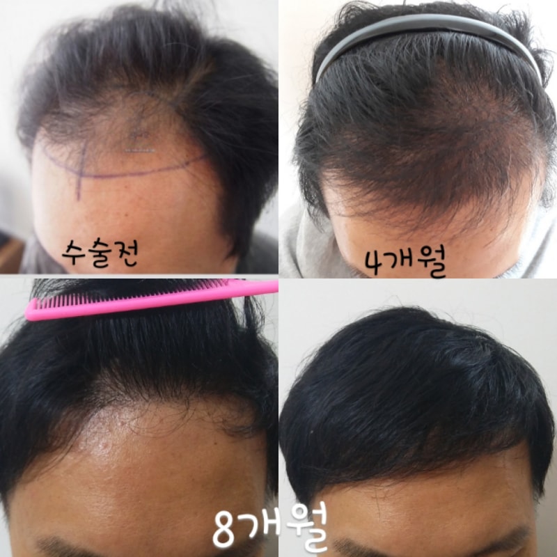 8개월이 되었습니다. 폭풍성장했어요 ^^~~~