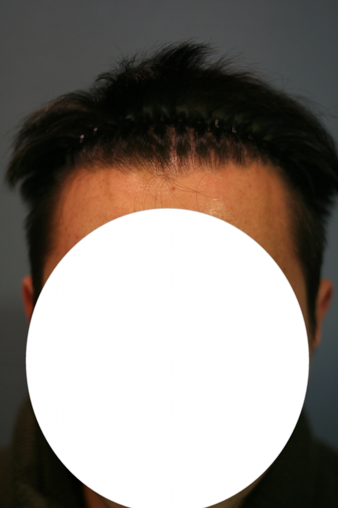 1년차.jpg