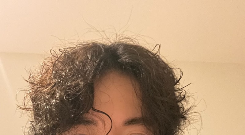 다나 무삭발비절개 15개월 style