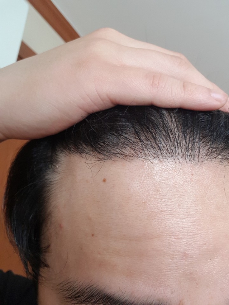 Look at the density of day 160