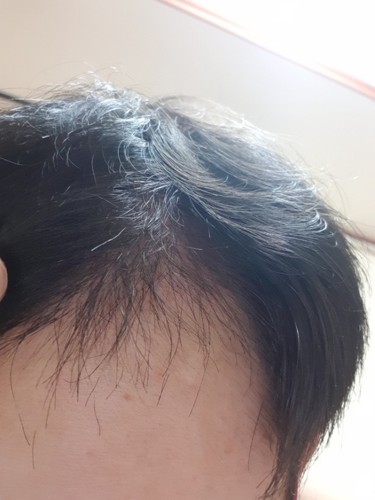 It's been a little over 2 months