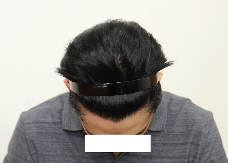 1년후위jpg.jpg