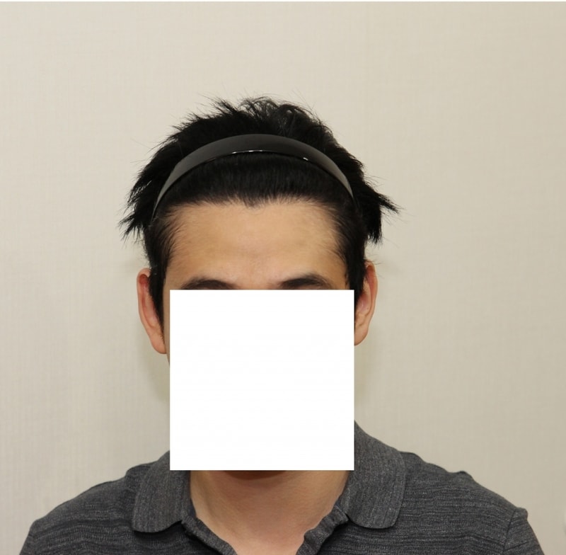 1년후정면.jpg