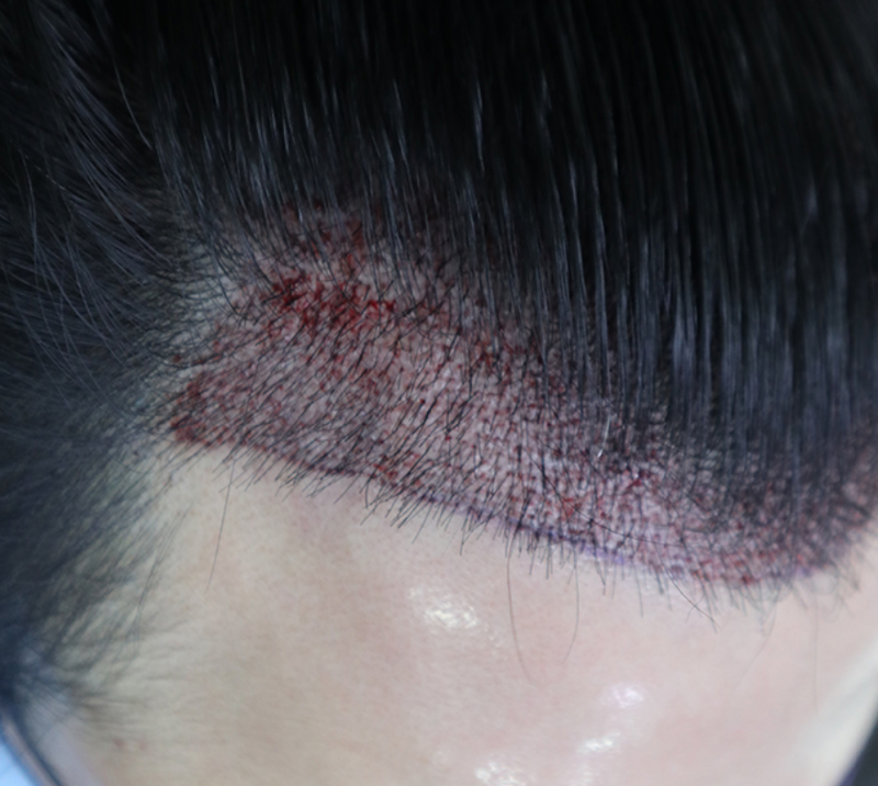 정영훈 02.png