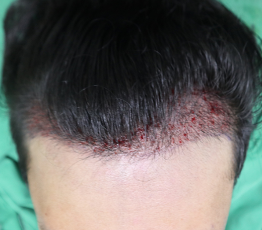 김승년디자인2.png