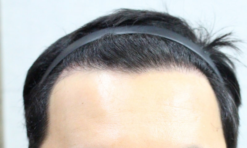 수술전1.jpg