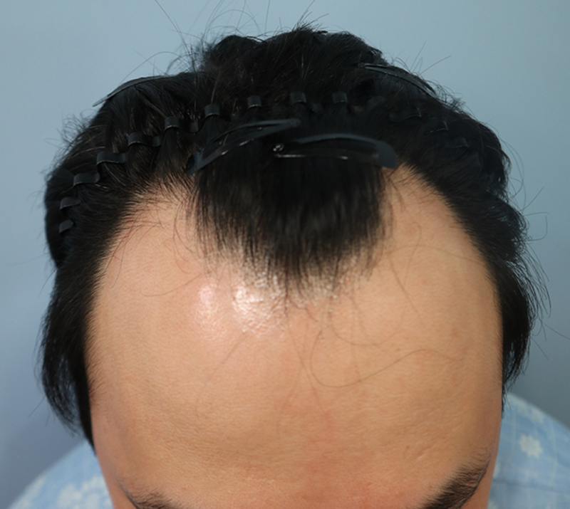 정영훈 01.png