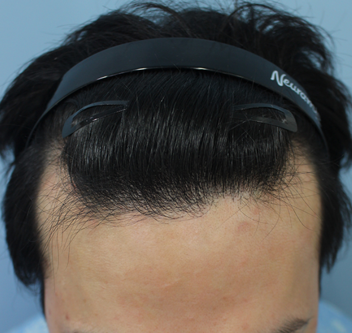 손재훈 1.png