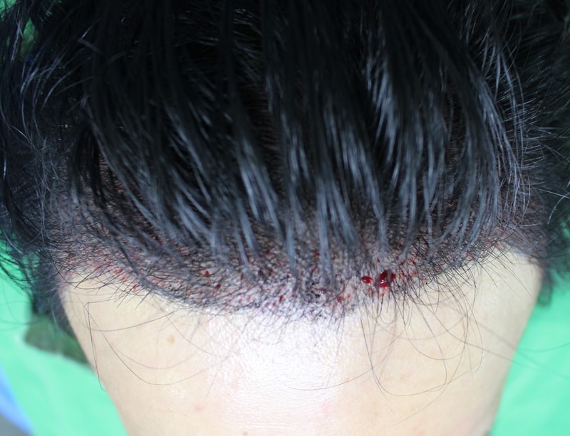석진우-술후1.jpg
