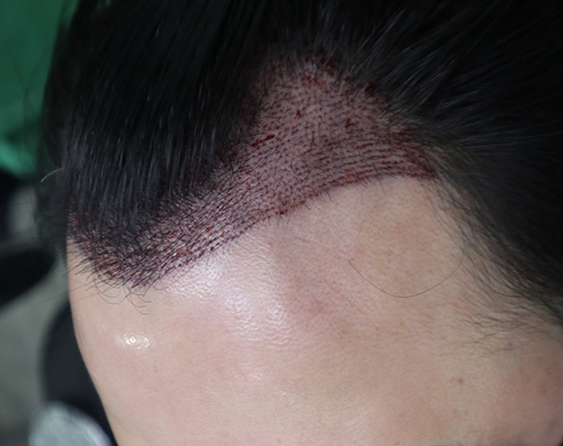 정영훈 03.png