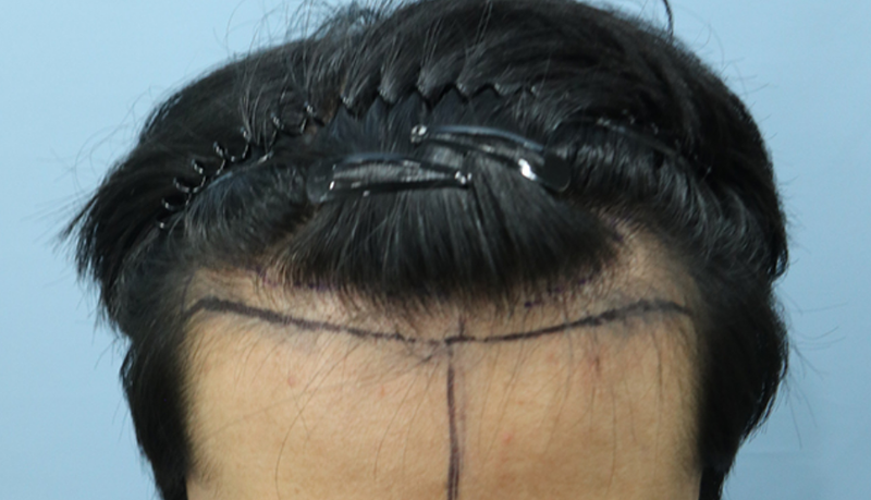민경훈 01.png