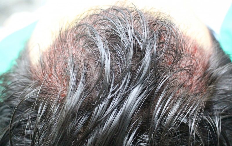 수술후2.jpg