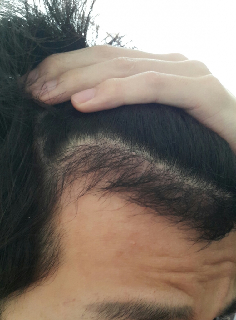20180316_151403-1.jpg