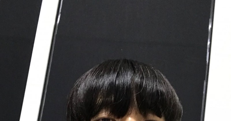 이식후 6개월 내림머리 (셀카).jpg