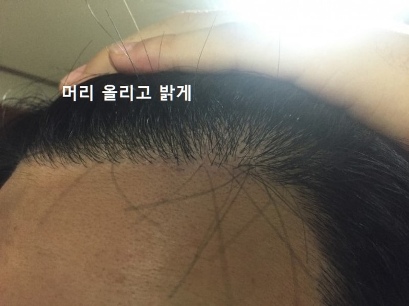 머리올리고 밝게.jpg
