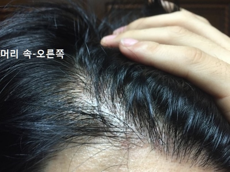 발게 오른쪽.jpg