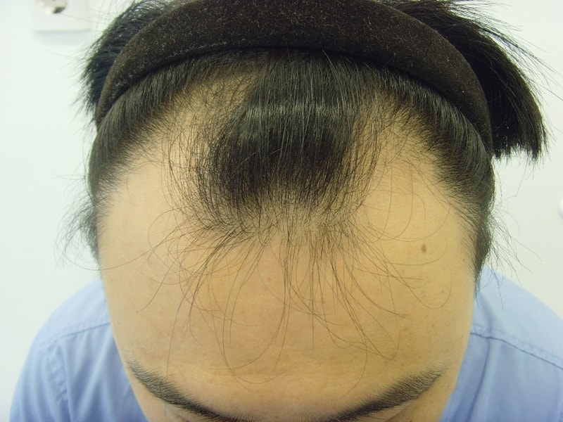 수술전 (1).jpg