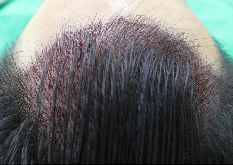 수술후1.jpg