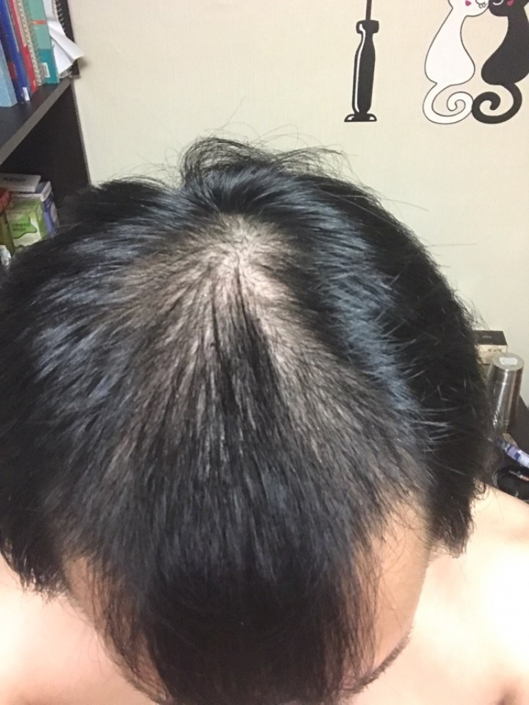 KakaoTalk_20170625_155235596.jpg
