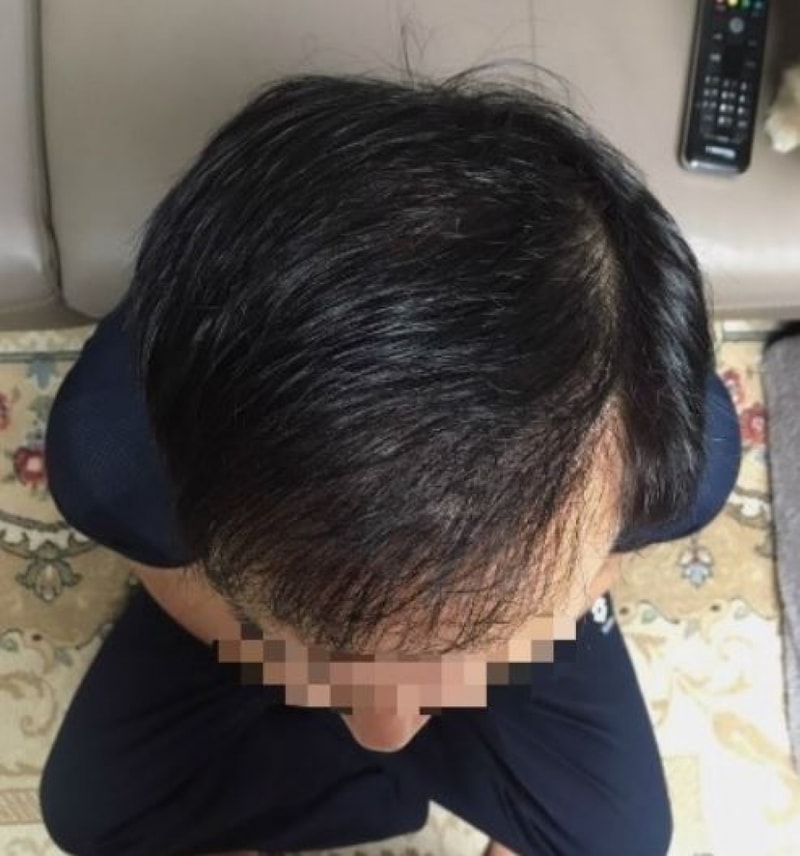 11월 앞머리.JPG