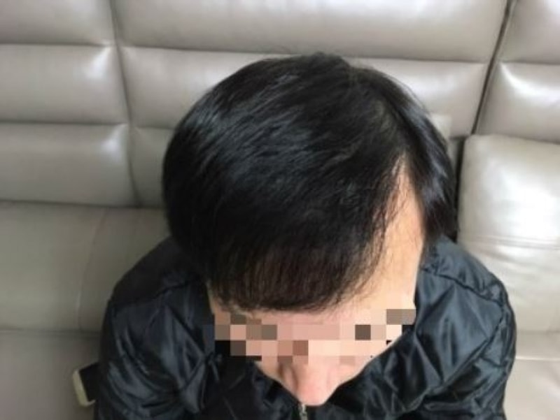 12월 앞머리.JPG