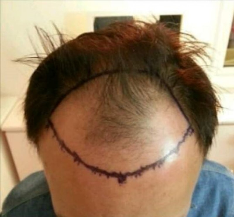비포.JPG
