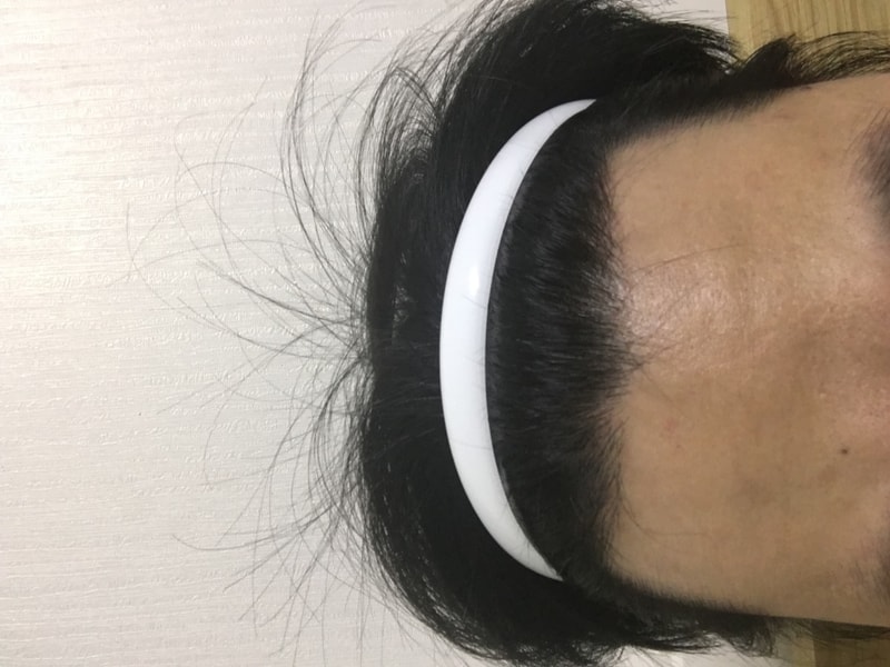 1600모낭8개월차후기