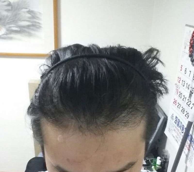 40일째.암흑기 겪고있습니다~