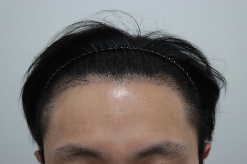 2600모 비절개 히든컷 3개월 암흑기 시작됐습니다