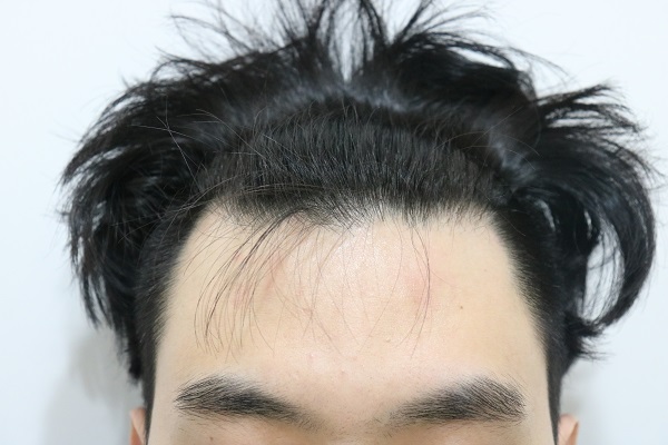 전정.jpg