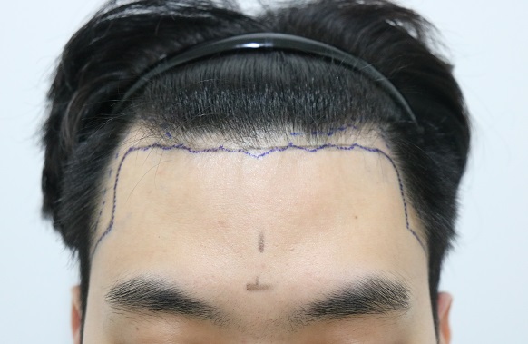 디.jpg