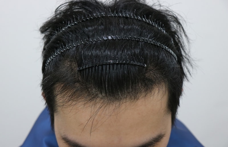 이동학 5개월 (3).jpg