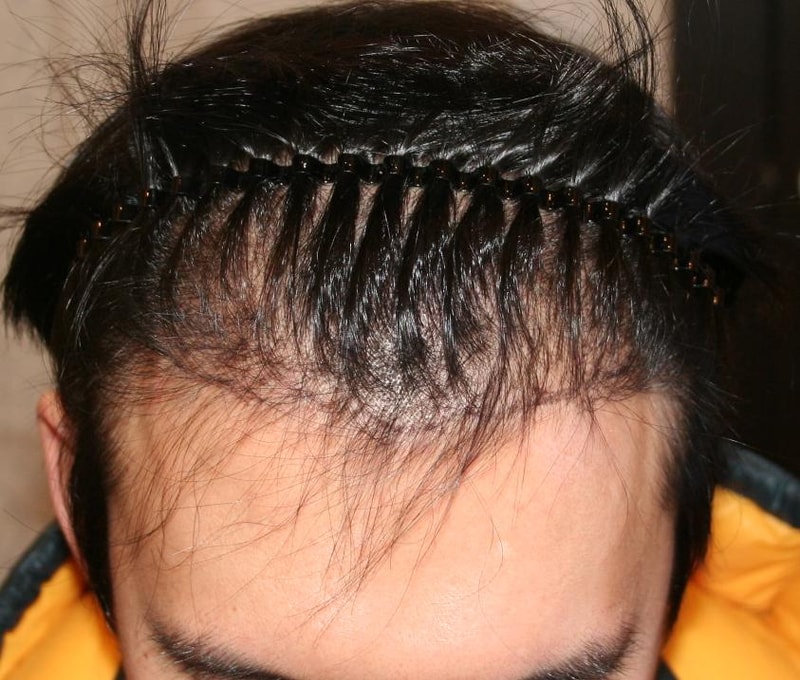 before.JPG