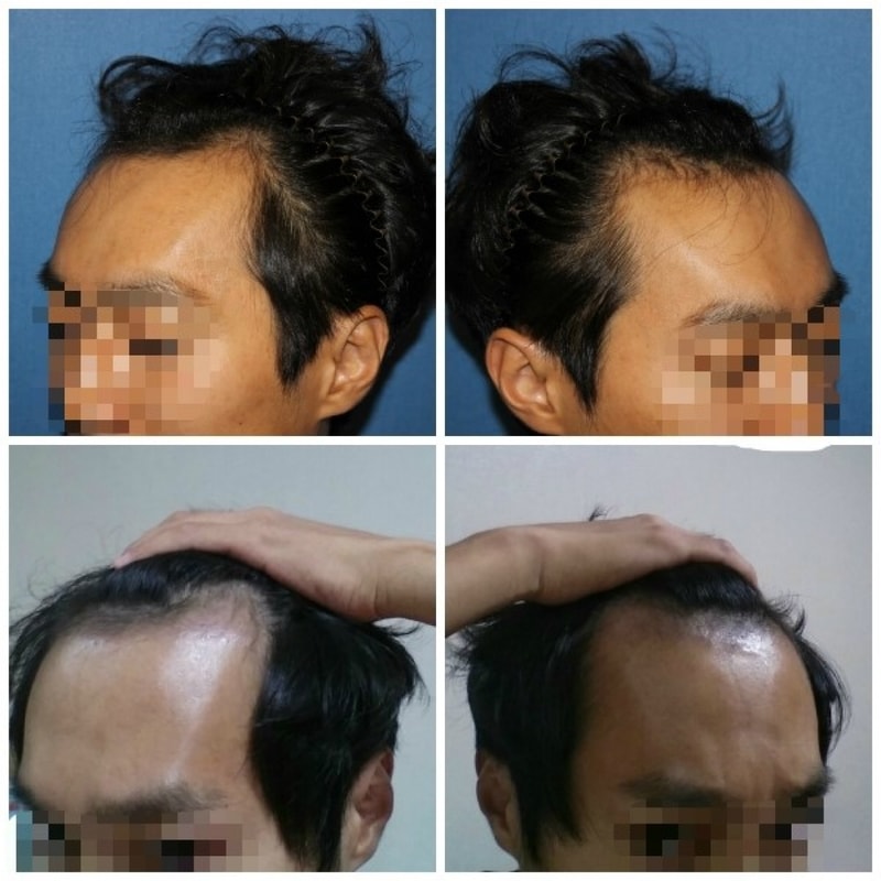 수술사진이다.jpg
