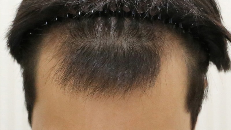 으익1.jpg