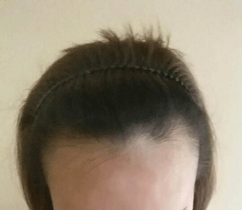 이마가반.gif