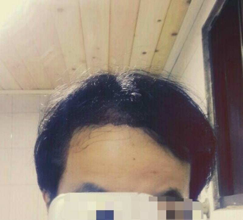 수술사진.jpg